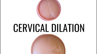 Cervical Dilation - up close!! screenshot 3