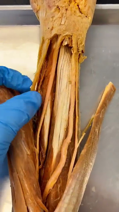 Inside a REAL Human Wrist
