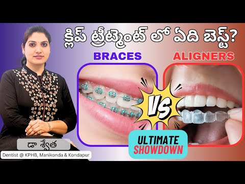 Which is Best for teeth alignment? Braces or Aligners with Cost comparison for all types in Telugu