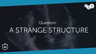 60 Seconds Of Echo Teaching Question A Strange Structure.