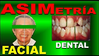 FACIAL AND DENTAL ASYMMETRIES (DIAGNOSIS AND TREATMENT IN ORTHODONTICS)
