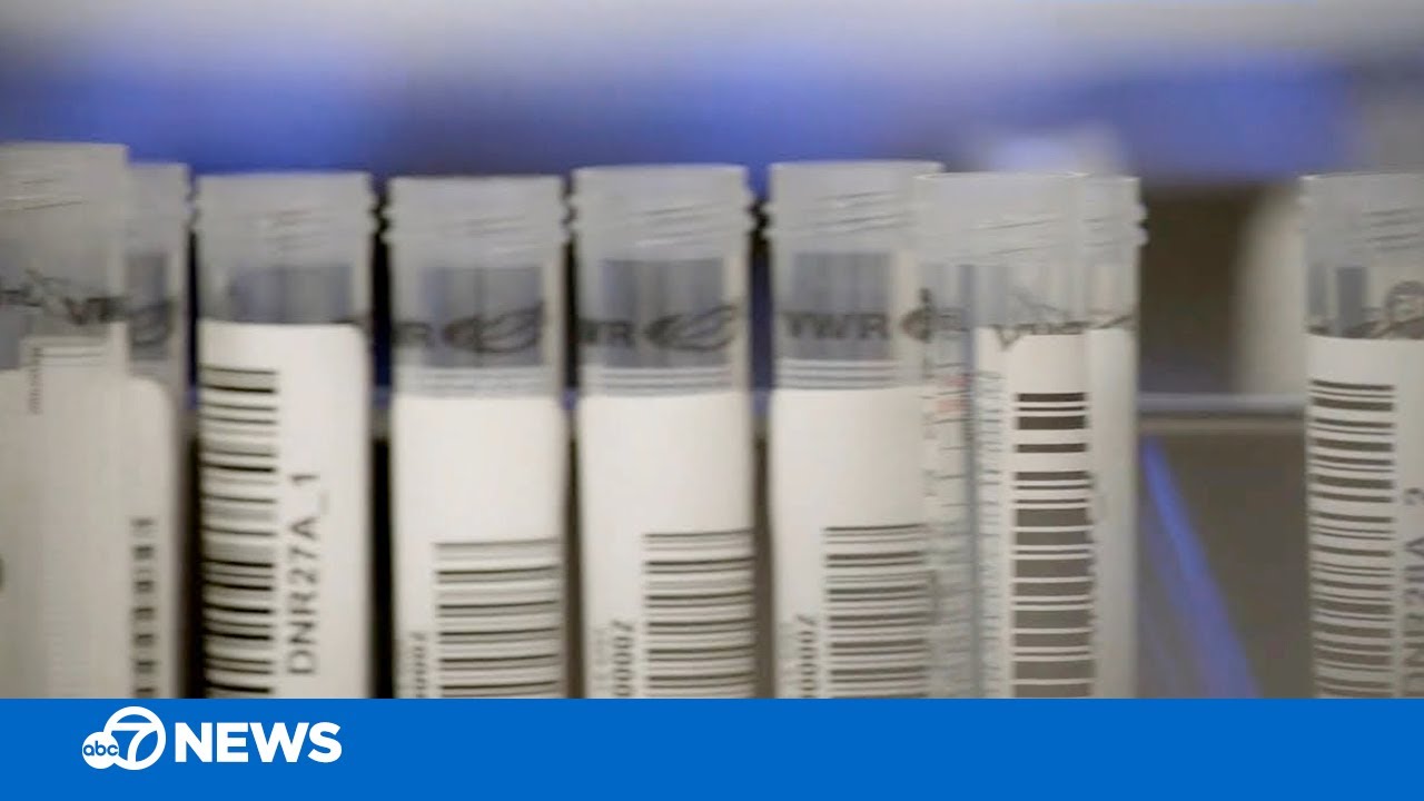 New blood test by Bay Area company can detect up to 50 types of cancer ...