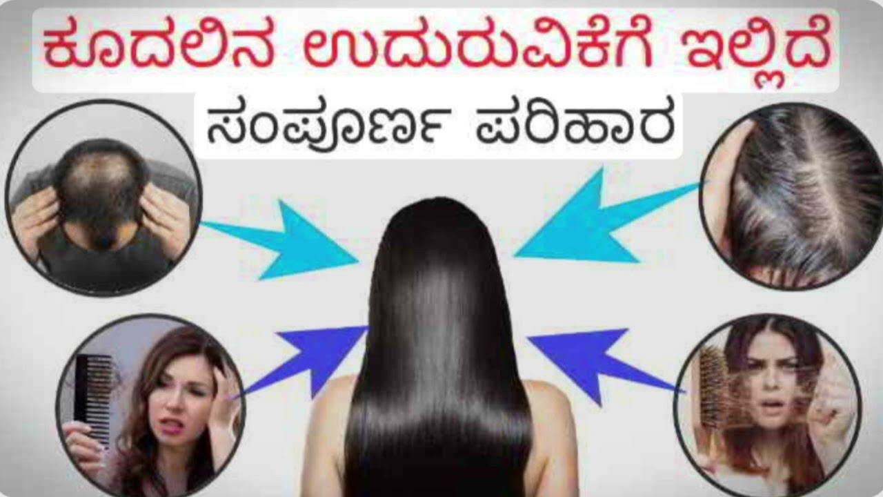 ಕೂದಲು ಉದುರುತ್ತಿದೆಯೇ  ಟೆನ್ಷನ್ ಬೇಡ#ಇಲ್ಲಿದೆ ಸಂಪೂರ್ಣ ಪರಿಹಾರ ಈ ವಿಡಿಯೋ ನೋಡಿ