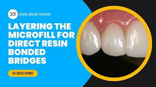 Layering the Microfill for Direct Resin Bonded Bridge with Dr Dennis Hartlieb DOT Course Clip