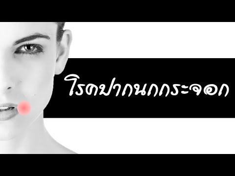 โรคปากนกกระจอก เป็นแล้วเจ็บปวด 11 วิธีรักษาโรคปากนกกระจอก 5 สมุนไพรรักษาไม่กลับมาเป็นอีก