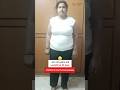 PCOD 18 Kgs Full Body Transformation #pcodweightloss #weightloss