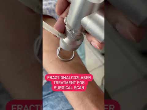 Surgical Scar Treatment