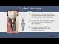 Les implants dentaires | TV de Salle d&#39;attente Dentiste