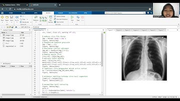 Segmentasi Citra Thorax (Tugas Pencitraan Biomedis)