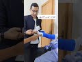 جبس الكسور Fracture Casting
