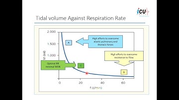 Adaptive Support Ventilation (ASV):  A Closed Loop Ventilation with Pressure-Targeted Mode