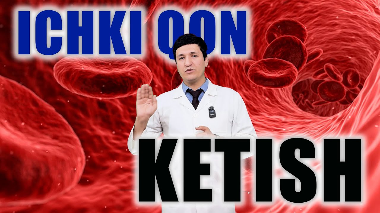Ichki qon ketish.(23-savol) Ички қон кетиш