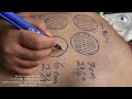 18 free online hijama  leech therapy course  hijama incision how to apply part 2