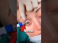 The Bizarre But Vital Eye Process 👀