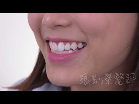 美白   張凱榮醫師