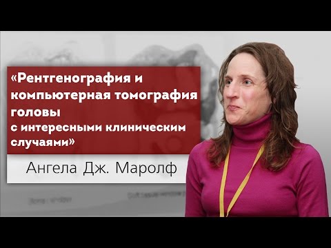 Рентгенография и компьютерная томография (КТ) головы