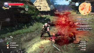 Witcher 3 - Brutal Combat Moments