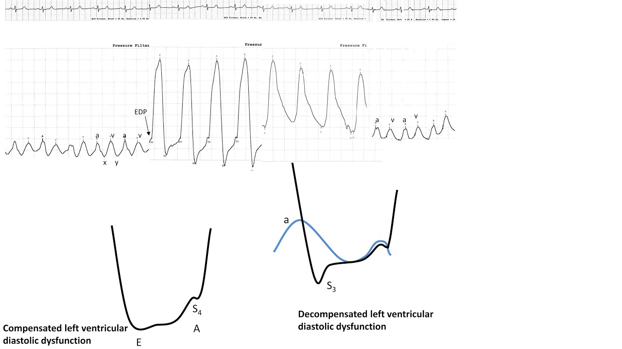 Hemodynamics 1: Essential hemodynamics, pitfalls, anomalies- Elias Hanna, Univ Iowa