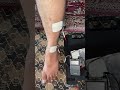 Stroke #physiotherapist #stroke #hijab