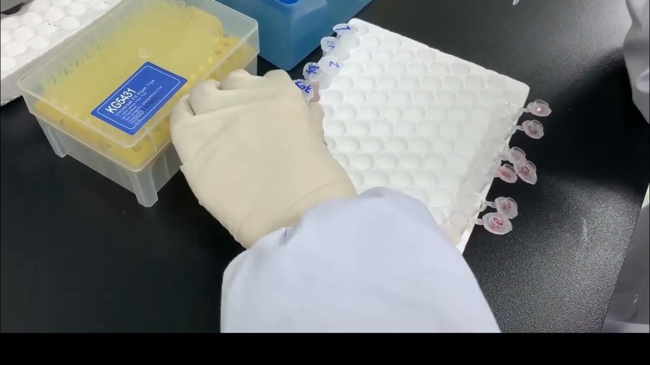 Aspergillus Galactomannan ELISA Detection Kit Operation YouTube