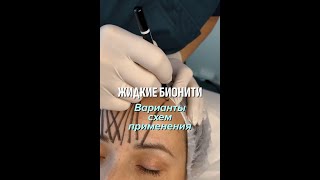 Все схемы в одном ролике. Derli Fibrolift Soft и Strong screenshot 3