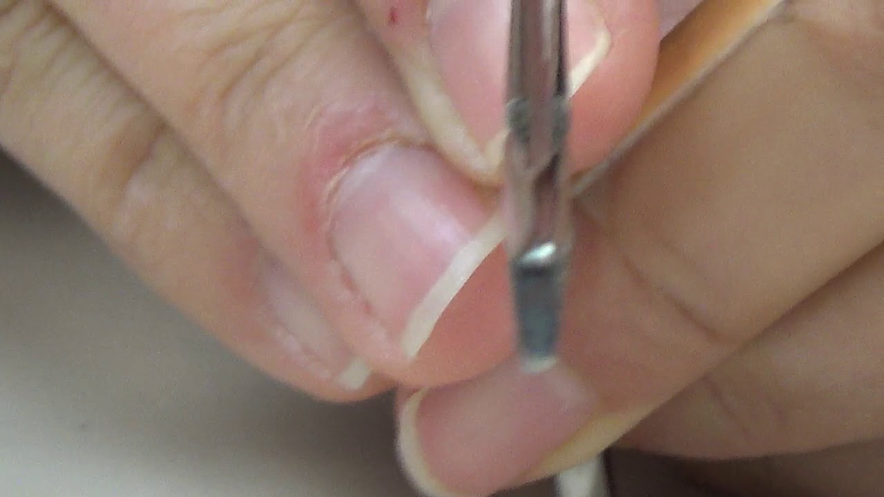 Needle Holders and Suction Tips