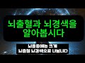 뇌졸증에 대해 알아봅시다 #뇌건강 #뇌혈관질환 #뇌건강운동