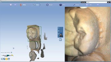 Planmeca PlanCAD® Easy 6.0 – Scanning Distance Indicatior