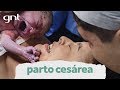 Parto cesárea após 36h com contrações espaçadas | Partos Emocionantes | Boas Vindas