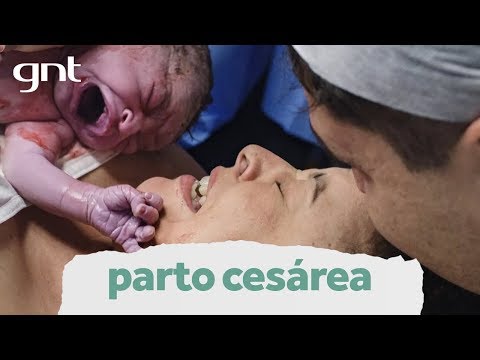 Vídeo: Não Apenas Números: Além De Contar Partos De Cesariana E Entender Seus Determinantes Em Gana Usando Um Estudo Transversal De Base Populacional