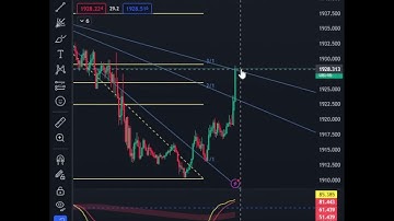 EP2 | FIBO RL3 ใช้งานกัน Scouter  #สูตรพิเศษ #fibonacci