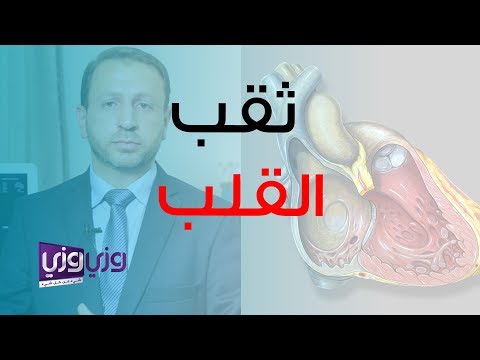 فيديو: معلومات عن نزيف القلب - نصائح حول تزايد فاينز Clerodendrum نزيف القلب