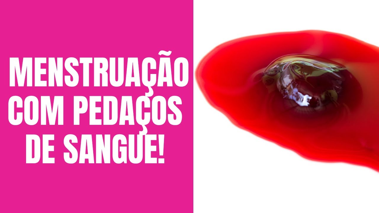 🔴MENSTRUAÇÃO EM PEDAÇOS/COÁGULOS DE SANGUE: O QUE PODE SER? - YouTube