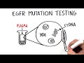 Clinical Utility of Liquid Biopsy for EGFR Mutation