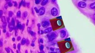 transitional epithelium | histo slide Slide Transitional Epithelium