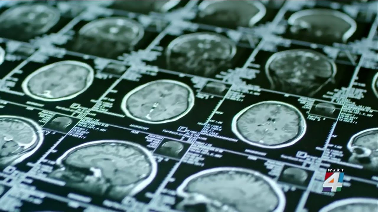 Hospitals raise concerns as supply chain issues are putting a damper in CT scans