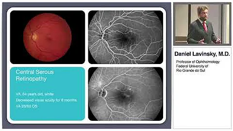 Topcon Pascal Endpoint Management AAO 2014 Daniel Lavinsky