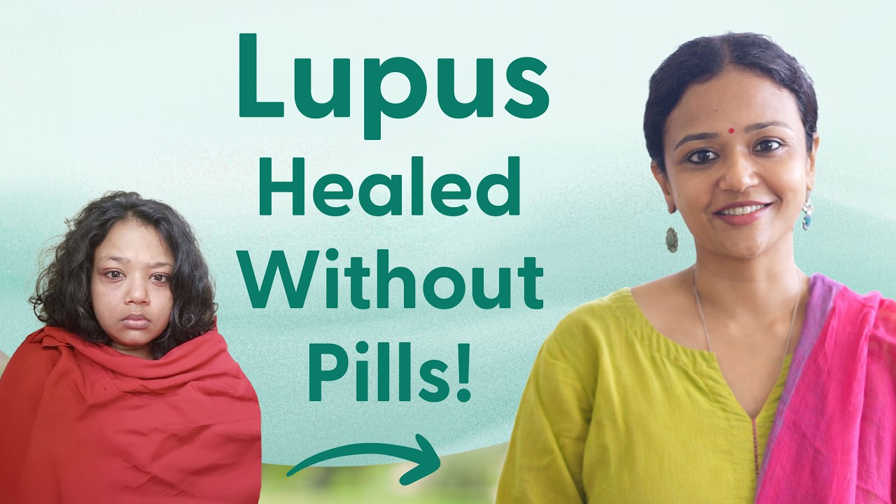 Managed Auto-Immune Disease Naturally | My Miracle Story