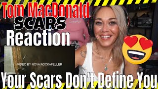 Tom MacDonald "Scars" Reaction