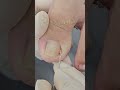 Ela mal conseguia andar… e olha o que eu tirei dali! #satisfying #nails #viralvideo