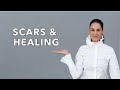 Scars and Wound Healing Facts!  by Sheila Nazarian, MD in Beverly Hills, Los Angeles