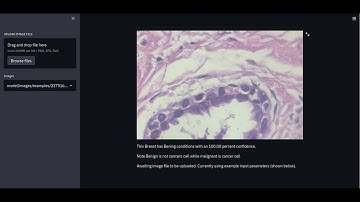 Image Classification model using tensorflow