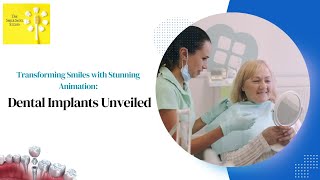 Transforming Smiles with Stunning Animation: Dental Implants Unveiled!