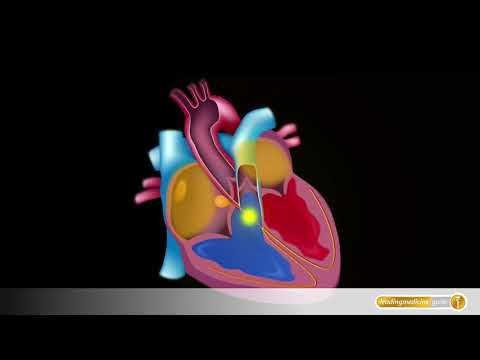 Anatomie: Elektrische Herzaktivität und Sinusknoten