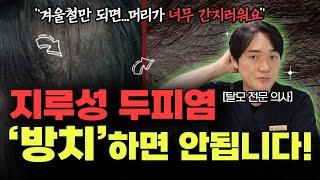 지루성 두피염 방치하면 안됩니다 !!!!