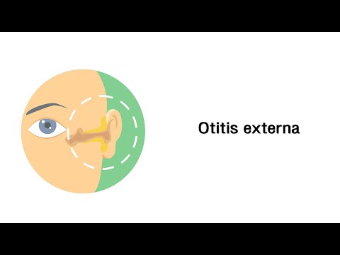 Video: Otitis Externa - Symptome, Typen, Ursachen