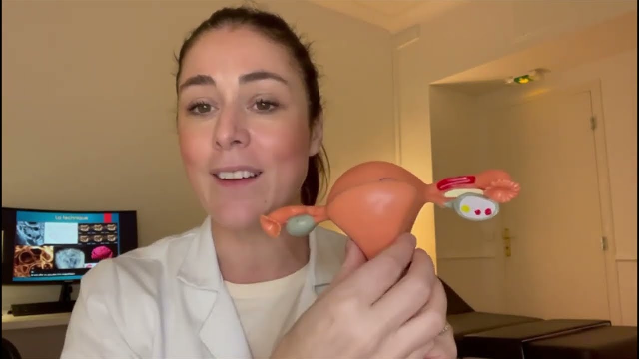 Adénomyose: qu'est ce que c'est? comment la reconnaitre ?