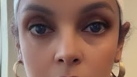 ወዲ ዓመት31  ንጋል 63  ዓመት ኣዲ ኡ ክሳዳ ቆሪጹ ሒዘዎ እንዳከደ ብፖሊስ ተታሒዙ ምጾታት