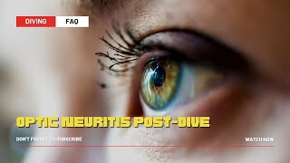 Optic Neuritis Post-Dive: A Rare but Serious Concern
