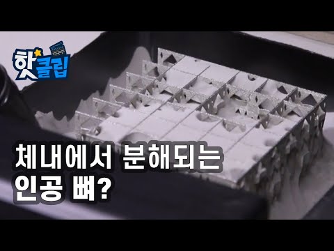 3D 프린터로 인공 뼈를 만든다? [핫클립] / YTN 사이언스